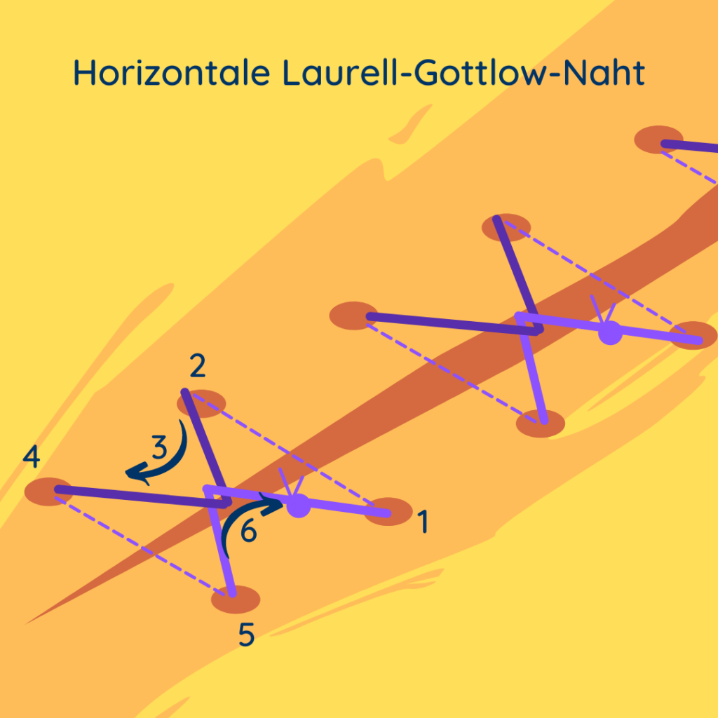 Nahttechniken: Abbildung zweier horizontaler Laurell-Gottlow-Nähte samt Stichmuster.