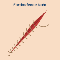 Nahttechniken-Fortlaufende-Naht-1-200x200.png